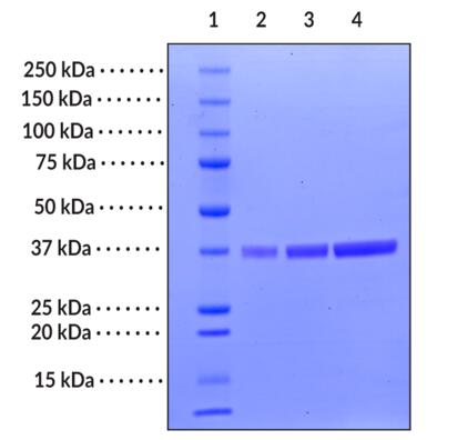 Lane 1: MW Markers<br />Lane 2: USP2 (1 μg)<br />Lane 3: USP2 (2 μg)<br />Lane 4: USP2 (4 μg)